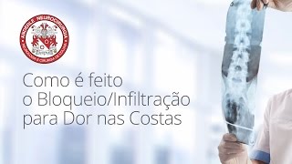 Como é feito o BloqueioInfiltração para Dor nas Costas  Dr Diogo Neurocirugião [upl. by Klimesh]