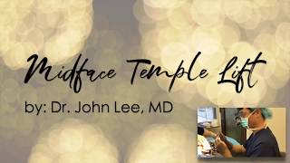 Midface Temple Lift at Dr John Lee Surgery [upl. by Chancey58]