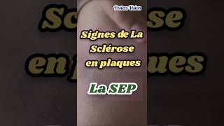 Signes Symptômes Sclérose en plaques SEP scleroseenplaques TroublesDuSommeil neurodegenerative [upl. by Aillicec424]