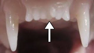 Worlds First Tooth Regrowing Drug Set To Start Human Trials [upl. by Imalda]