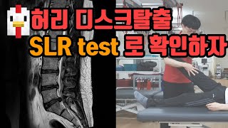 iamPT허리디스크탈출증을 검사하기 위한 SLR test를 정확하게 해보자 [upl. by Skeie]