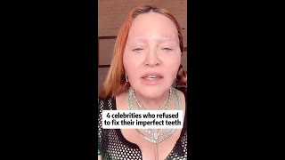 4 Celebrities Who Embraced Their Imperfect Teeth – Hollywood Stars Defying Beauty Norms [upl. by Epilef]