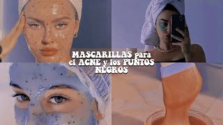 MASCARILLAS para ELIMINAR el ACNÉ y los PUNTOS NEGROS 🧖🏻‍♀️💗  softly [upl. by Alih]