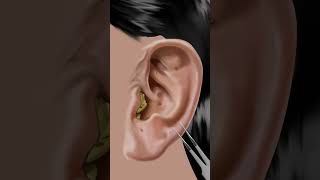 asmr Itchy amp Smelly Ear Stone Removal animation beauty ear [upl. by Adalheid]