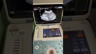 Esaote Ultrasound Demo Video [upl. by Stubbs]