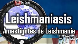 Amastigotes de leishmania  Leishmaniasis viceral [upl. by Lletnahs832]