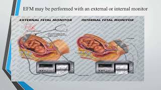 Intrapartum fetal surveillance [upl. by Winser]