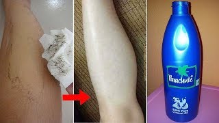 தேவையற்ற முடியை நீக்கி விட்டேன் மீண்டும் வரவே வராதுUnwanted Hair Removal in Tamil [upl. by Lesli768]