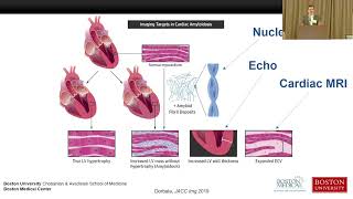 Imaging in ATTR Cardiac Amyloidosis How it is used for Diagnosis and Treatment Response [upl. by Buckler]