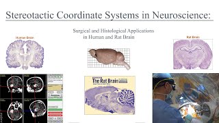 Stereotactic Coordinate Systems in Neuroscience and Medicine Applications in Rat and Human Brain [upl. by Dibbell]