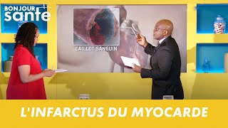 LINFARCTUS DU MYOCARDE  BONJOUR SANTE [upl. by Hauhsoj]