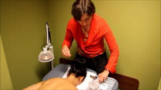 Acupuncture Demonstration and Benefits [upl. by Nelaf]