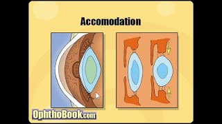 Optometry with Chanaka 11 Refractive Errors Sinhala [upl. by Nnayram]