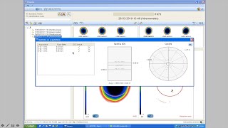 Peramis wavefrontguided LASIK programming [upl. by Kcirdlek808]