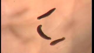 Meet the humble planaria  humble but tricky [upl. by Eineeuq323]