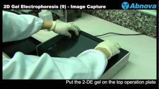 2D Gel Electrophoresis 9 Image Capture  UV Light Box [upl. by Aiam]