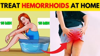 How To Treat Hemorrhoids  7 Natural Treatments Plant Flavonoids for Hemorrhoidal Disease [upl. by Vera]