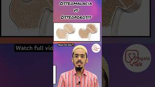 Osteomalacia vs osteoporosis  Difference between osteomalacia amp osteoporosis shorts [upl. by Valera]