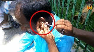 ►WOW  Amazing Street Ear Cleaning in Bangladesh II Incredible Poisonous Ear Wax II Street Life BD [upl. by Atsirk569]