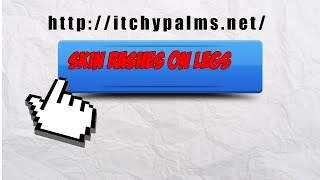 Itchy PalmsnetSkin Rashes On Legs [upl. by Ranson86]