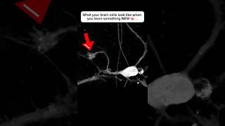 Brain cell restructures itself after forming a new connection neuroplasticity neuroscience brain [upl. by Ahseila]