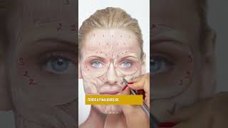 Botox Full Face Planejamento detalhado [upl. by Anauqahs963]