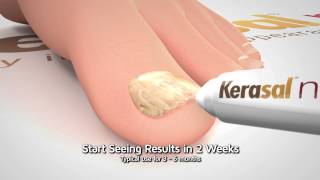 Kerasal Nail Restore Healthy Nail Appearance 10 Sec [upl. by Enttirb]