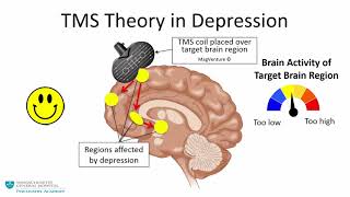 Transcranial Magnetic Stimulation A New Treatment Approach for Psychiatric Disorders [upl. by Llerehs]