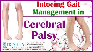 Intoeing Gait Management in Cerebral Palsy  Trishla Foundation [upl. by Birch]