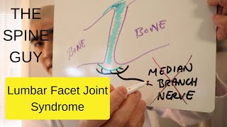 Lumbar Facet Joint Syndrome [upl. by Trebron]