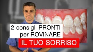 2 consigli pronti per ROVINARE il tuo sorriso con lapparecchio fisso [upl. by Notkcorb]