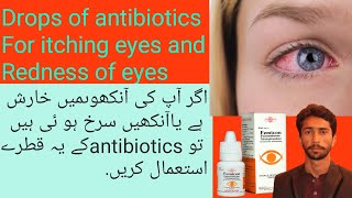 Eye Drops for itching eyes redness eyelid inflammation allergic eyes urdu baloch pharmacy wala [upl. by Efinnej219]