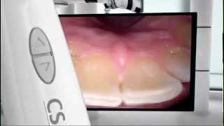 CAMARA INTRAORAL CS1200 [upl. by Hsirk667]