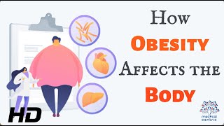 The Heavy Burden of Obesity Understanding its Effects on Your Body [upl. by Laemsi]