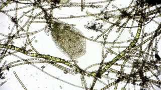 🔬 Mikroorganismus  microcosmos  plump microorganism  life under the microscope in Full HD [upl. by Nylhsa805]