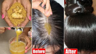 I applied👆🏼Worlds Fastest Hair Growth Mix on my Bald Scalpfor Double Hair Growth amp Double Density [upl. by Ravens]