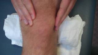 physical therapy guru patellar mobilizations [upl. by Ellehcsar]