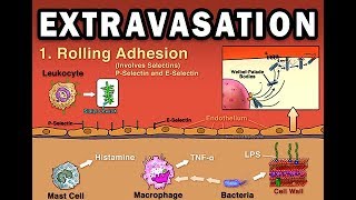 EXTRAVASATION [upl. by Lichtenfeld]