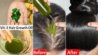 I Put👆🏼This Hair Growth Oil Daily on Hair Loss Areas amp ScalpGot Double Hair DensityThickLong Hair [upl. by Helgeson]