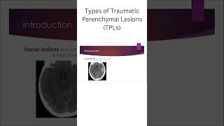 Types of Traumatic Parenchymal Lesions TPLs [upl. by Ilysa]