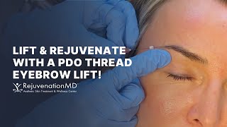 Get a NonSurgical Brow Lift with PDO Threads [upl. by Aidne306]