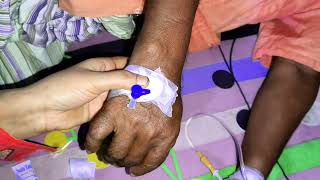 Intravenous cannulation methodCannula insertion technique bengali easy [upl. by Cavil]