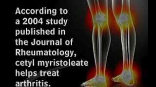 Treating Arthritis with Cetyl Myristoleate [upl. by Anom]