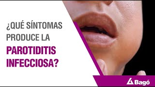 ¿QUÉ SÍNTOMAS PRODUCE LA PAROTIDITIS INFECCIOSA [upl. by Atnomed]