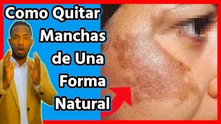 Tratamiento casero para las MANCHAS EN TU CARA es totalmente natural [upl. by Riamo]