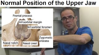 What is the Normal Position Posture of the Upper Jaw Maxilla or Palate by Dr Mike Mew [upl. by Ahsilat55]