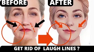 27 MIN  HOW TO GET RID OF NASAL FOLDS  LAUGH LINES amp JOWLS FOREHEAD LINES EYEBROWS FROWN LINES [upl. by Zaid]