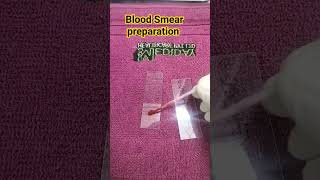 Blood Smear Preparation [upl. by Gordon]