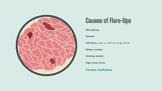 Psoriasis Signs Symptoms Causes and Treatment  Merck Manual Consumer Version [upl. by Ardiedak478]