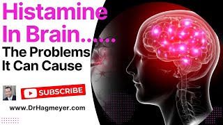 Is Excess Brain Histamine The Cause of Your Symptoms Histamine causes brain fog [upl. by Arihsaj]